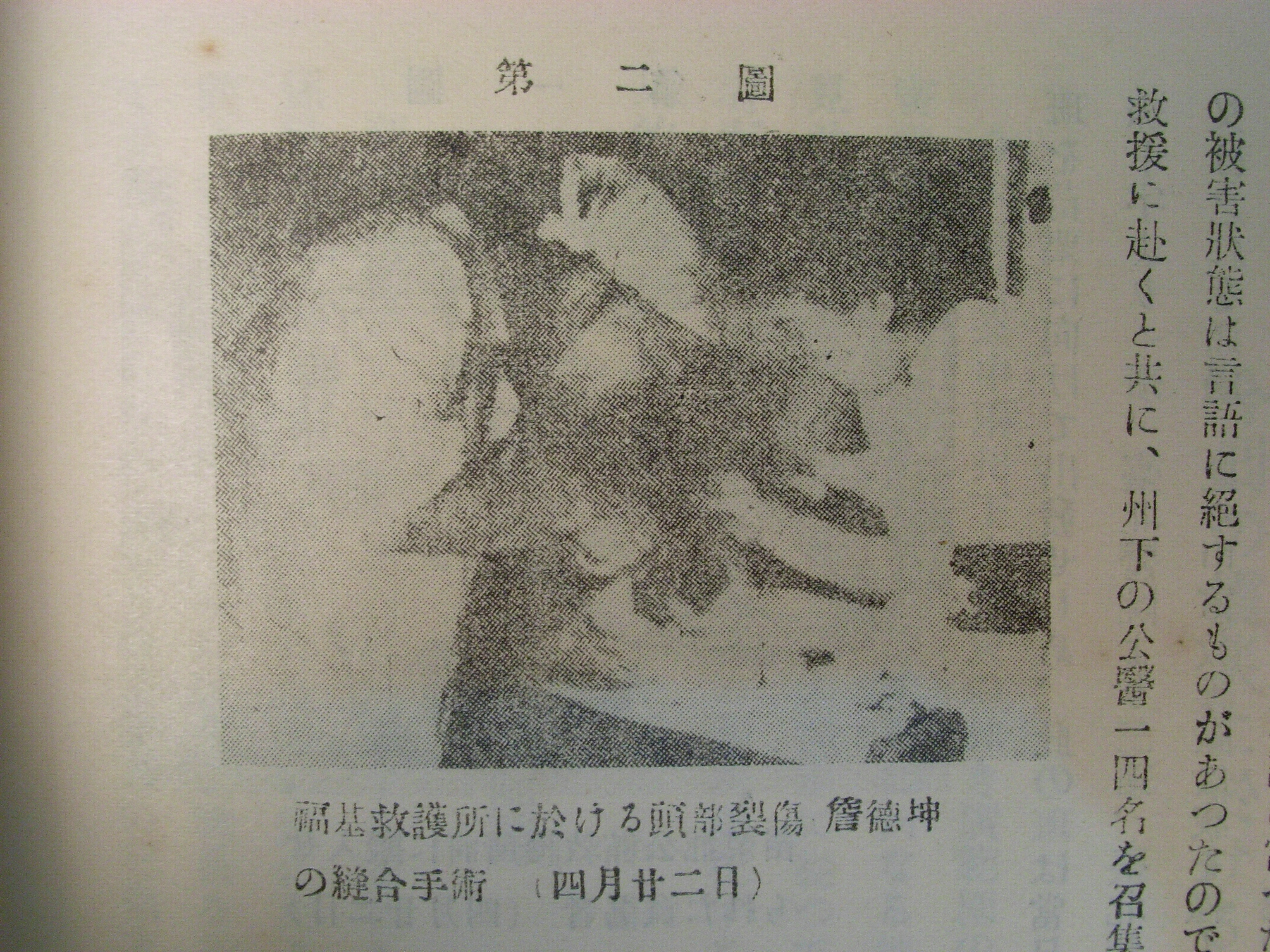 昭和10年4月22日，詹德坤於福基救護所進行頭部裂傷縫合手術，翻拍自《昭和十年新竹州震災誌》